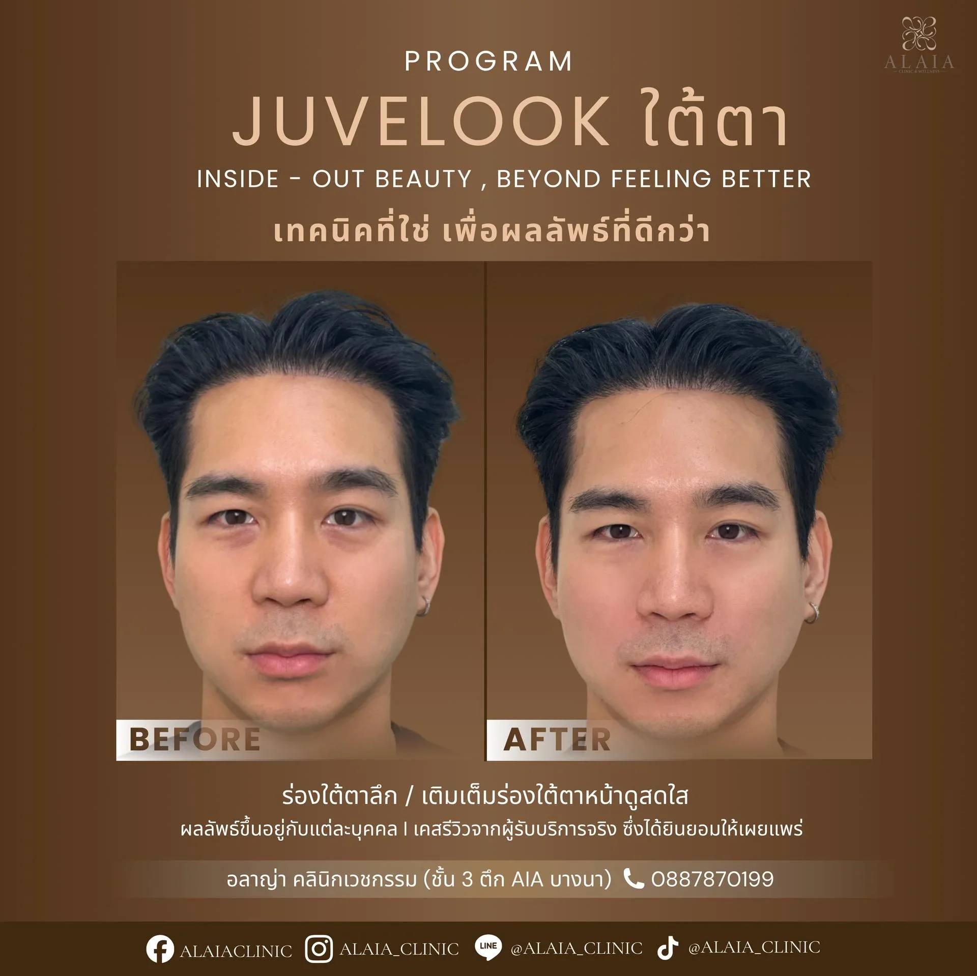 Program Juvelook Review